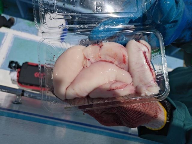 ショウサイフグ